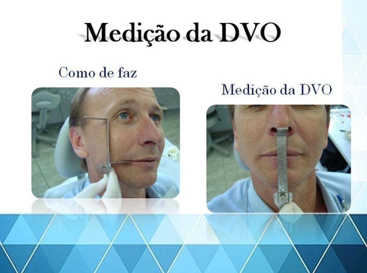 medicao-dvo